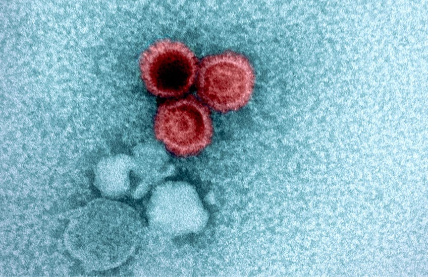 Investigadores de Harvard revelan por qué algunos virus persisten en el cuerpo toda la vida