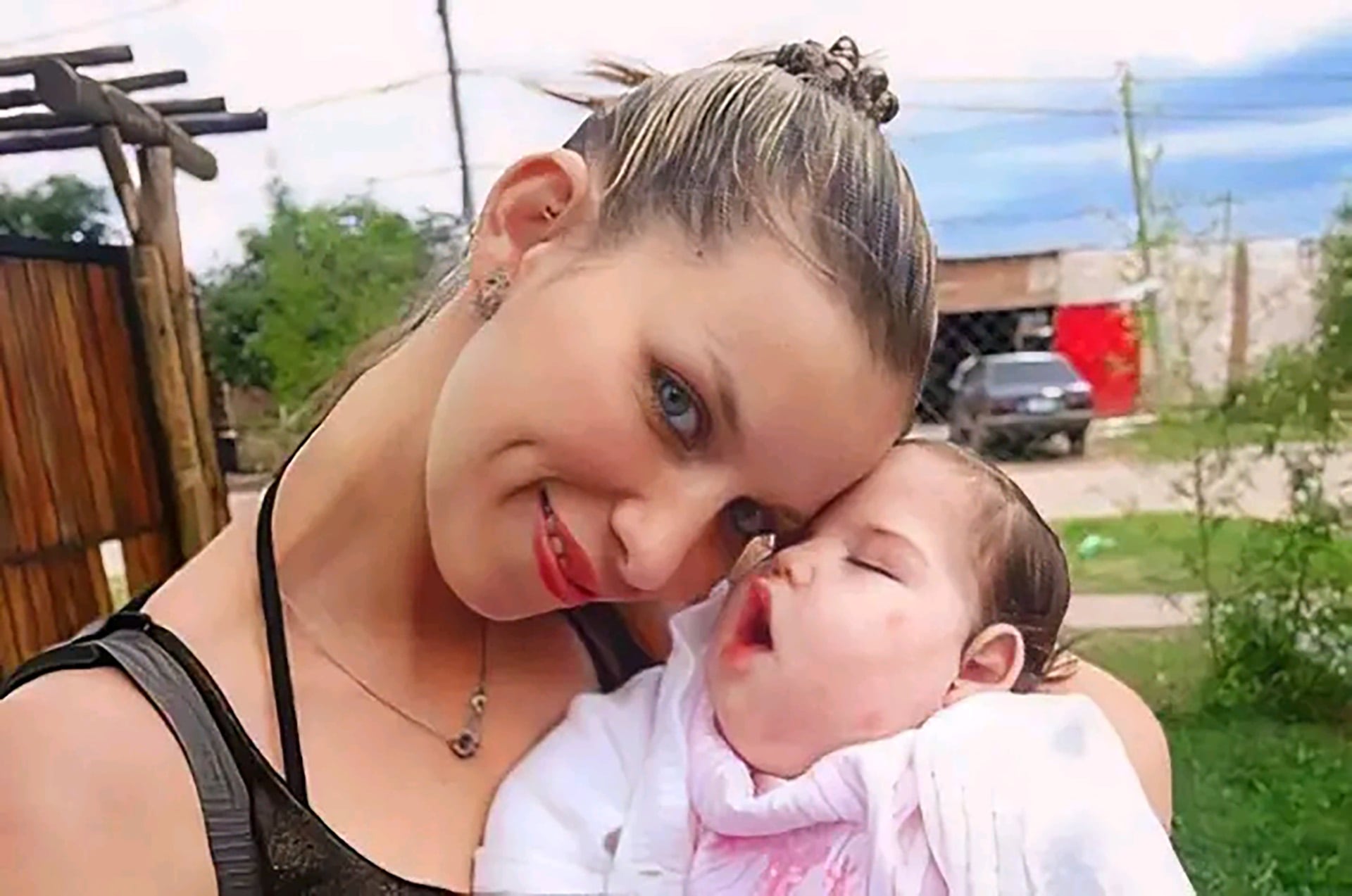 Una beba dada por muerta, secuelas neurológicas irreversibles y un fallo que agudizó el dolor: “La justicia se nos rio en la cara”